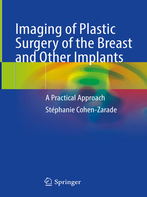 cover image of Imaging of Plastic Surgery of the Breast and Other Implants